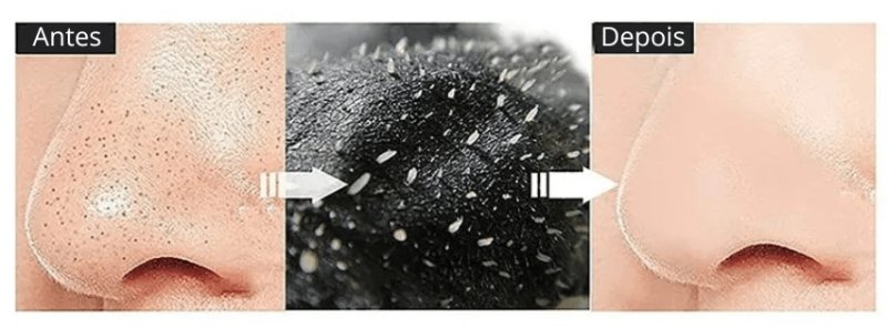 Diga Adeus aos Cravos com Nosso Adesivo Milagroso!